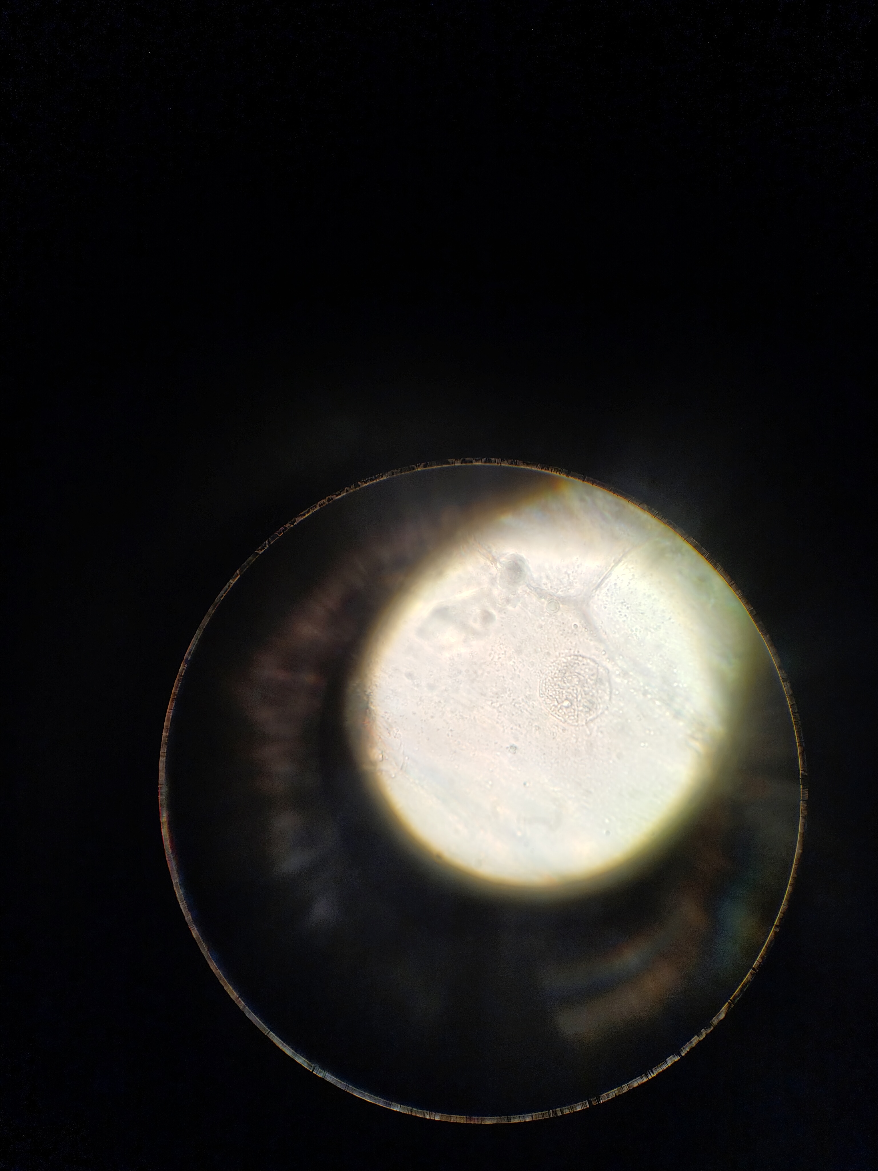 Фото с микроскопа