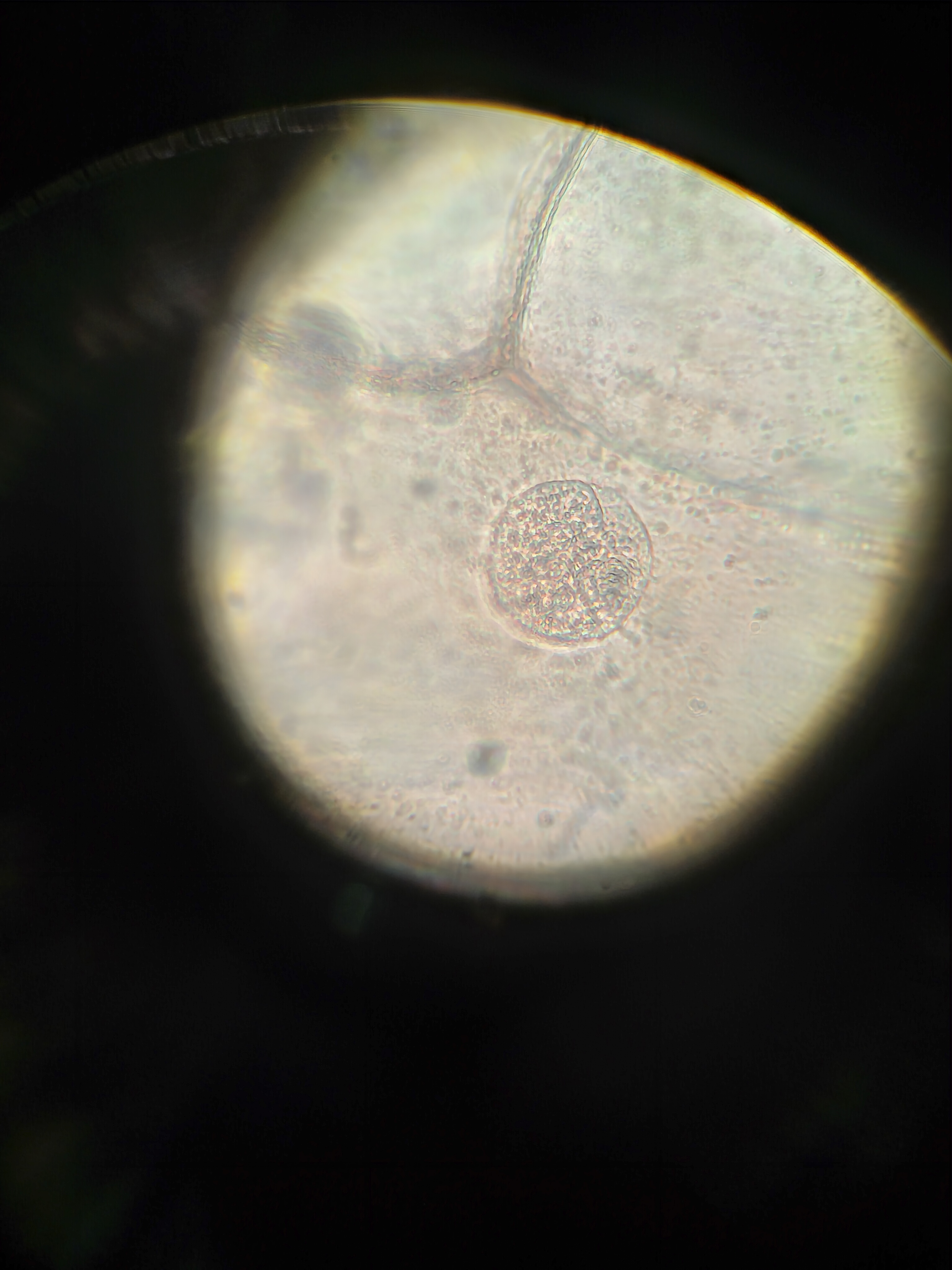 Фото с микроскопа